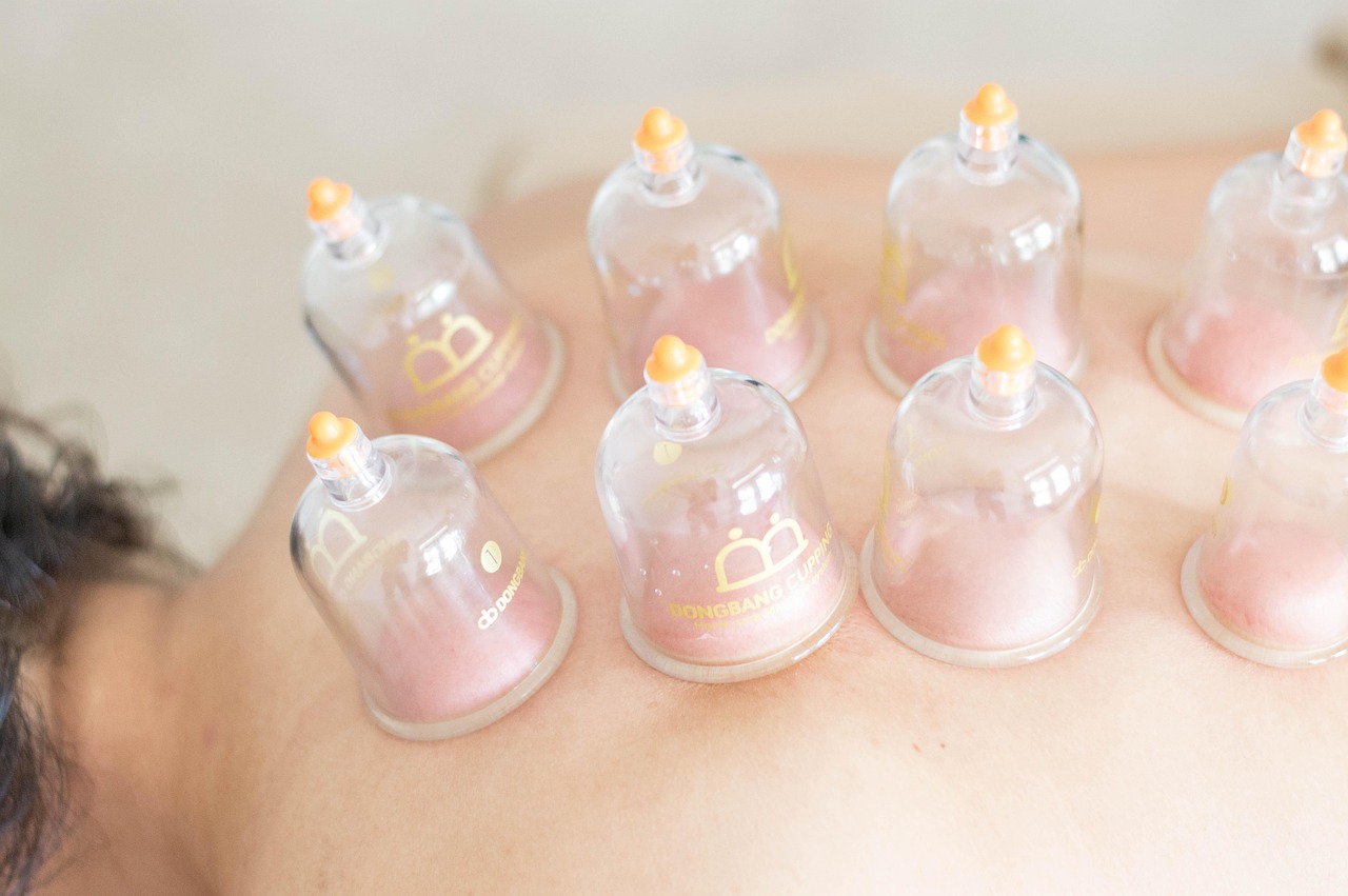 massage, therapy, body, alternative, treatment, cupping, massage, therapy, cupping, cupping, cupping, cupping, cupping